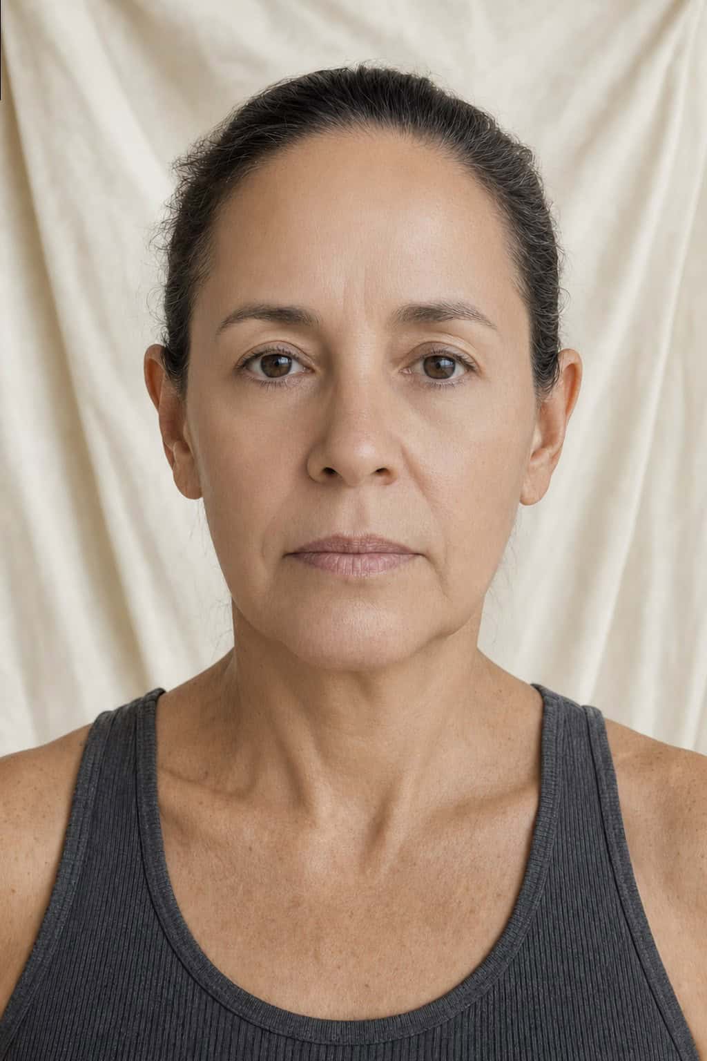 AI CO2 laser resurfacing preview of the same computer-generated face, rendered by PreviewMD